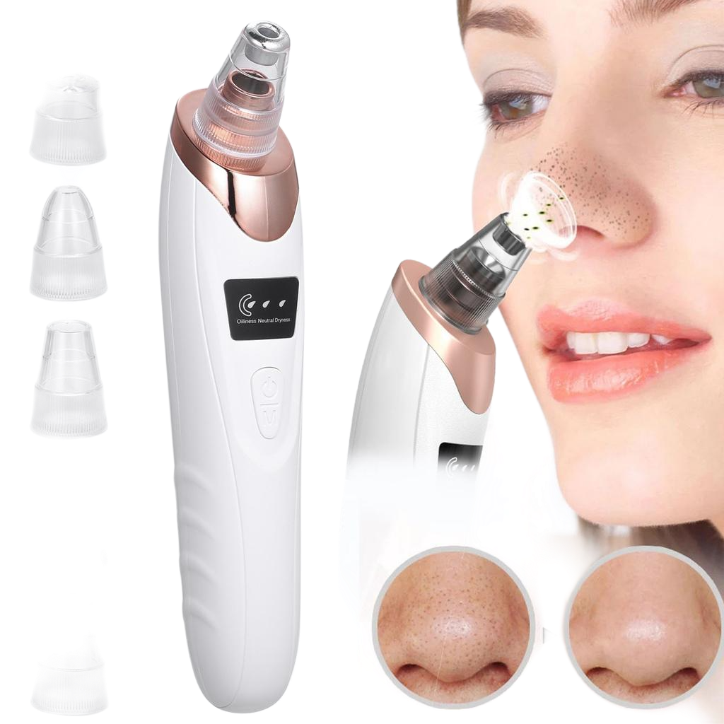 5-in-1 Blackhead Remover