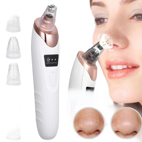 5-in-1 Blackhead Remover